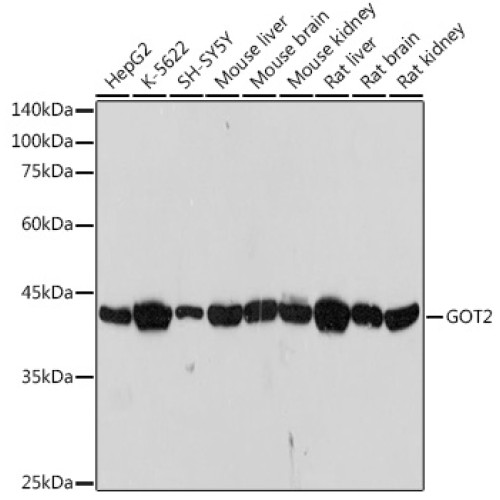 GOT2 Rabbit mAb