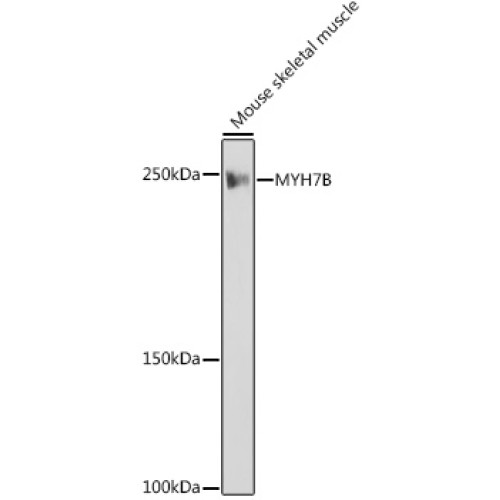 MYH7B Rabbit mAb