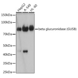 beta glucuronidase (GUSB) Rabbit mAb
