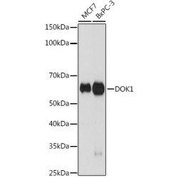 DOK1 Rabbit mAb