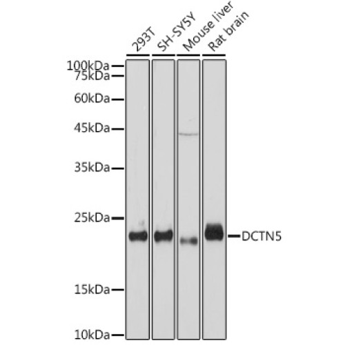 DCTN5 Rabbit mAb