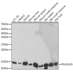 PLA2G2A Rabbit mAb