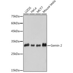Gemin 2 Rabbit mAb