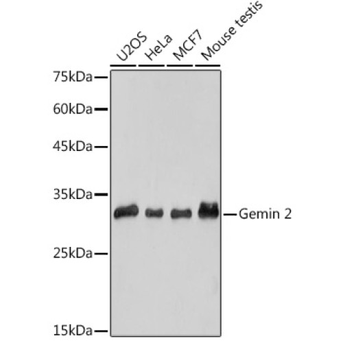 Gemin 2 Rabbit mAb