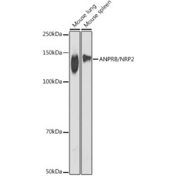 ANPRB/NPR2 Rabbit mAb