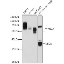 MICA Rabbit mAb