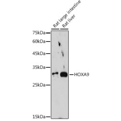 HOXA9 Rabbit mAb