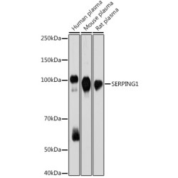 SERPING1 Rabbit mAb