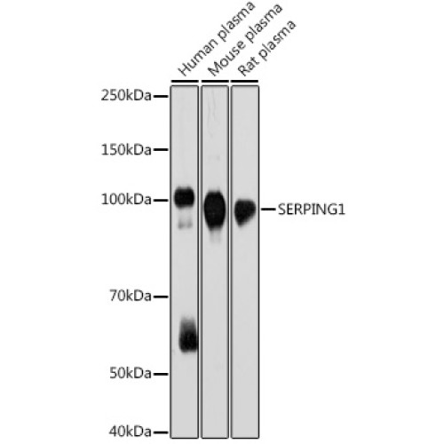 SERPING1 Rabbit mAb