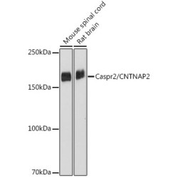 Caspr2/CNTNAP2 Rabbit mAb