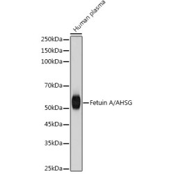 Fetuin A/AHSG Rabbit mAb