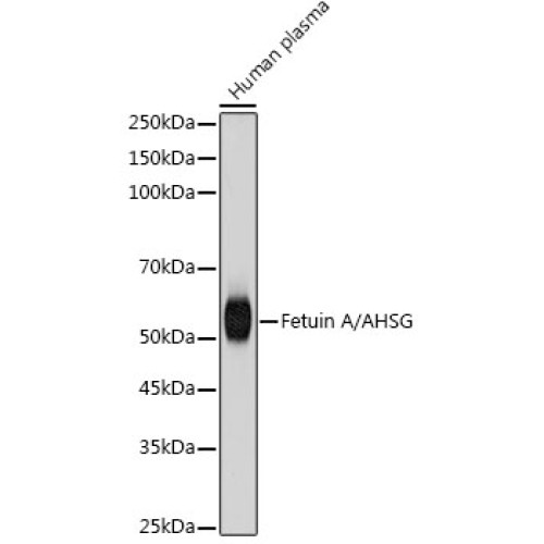 Fetuin A/AHSG Rabbit mAb
