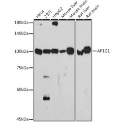 AP1G1 Rabbit mAb