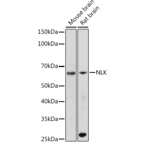 NLK Rabbit mAb
