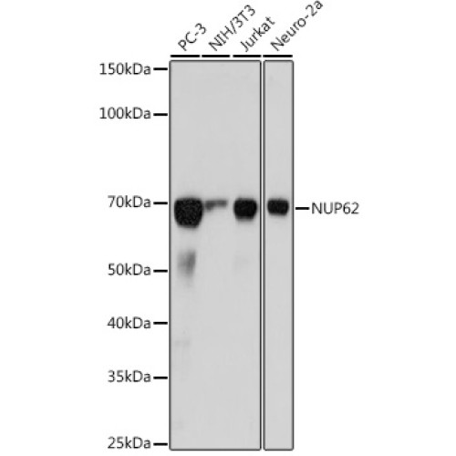 NUP62 Rabbit mAb