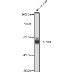 ACVR1 Rabbit mAb