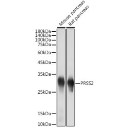 PRSS2 Rabbit mAb