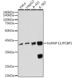 hnRNP E1/PCBP1 Rabbit mAb