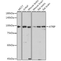 ATRIP Rabbit mAb
