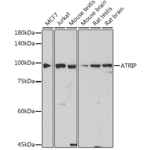 ATRIP Rabbit mAb