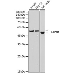ATP4B Rabbit mAb