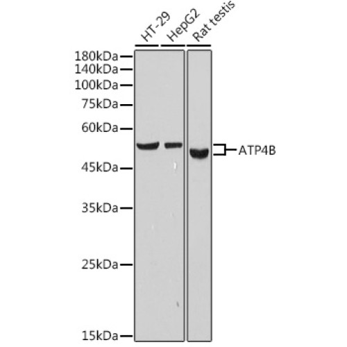 ATP4B Rabbit mAb