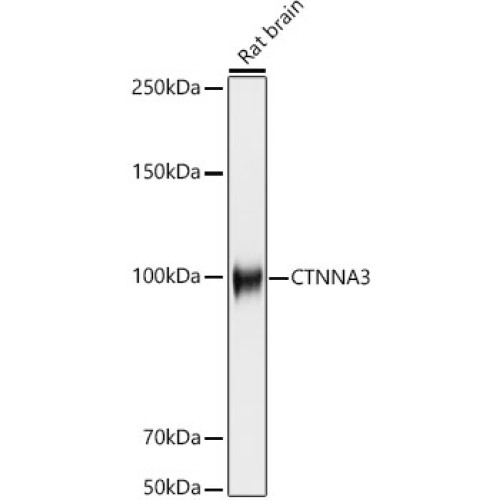 CTNNA3 Rabbit mAb