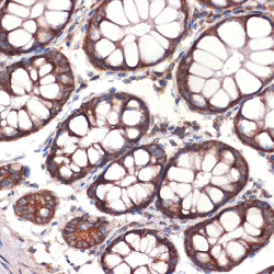 CC2D1A Rabbit mAb