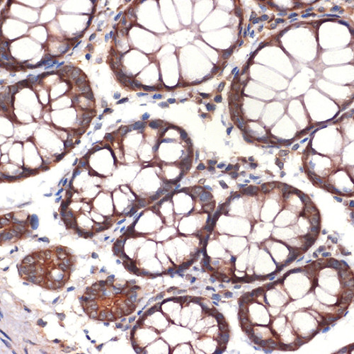 CC2D1A Rabbit mAb