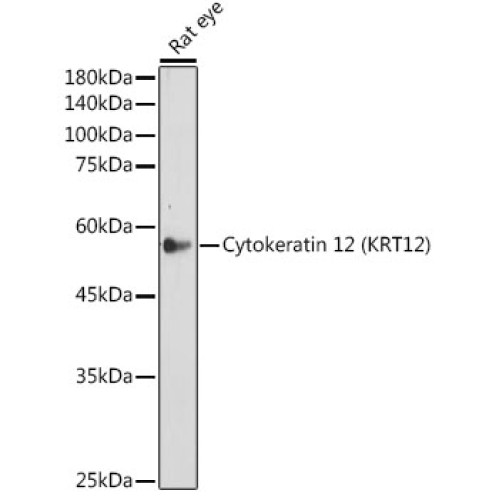 Cytokeratin 12 (KRT12) Rabbit mAb