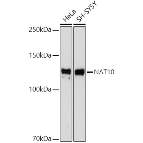 NAT10 Rabbit mAb