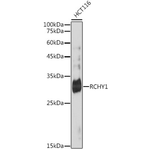 RCHY1 Rabbit mAb