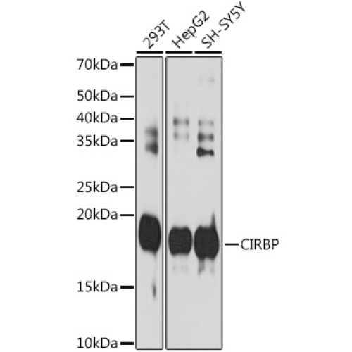 CIRBP Rabbit mAb