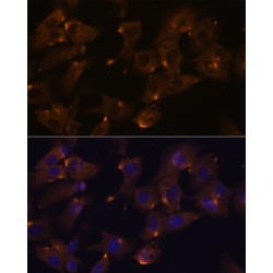 ARVCF Rabbit pAb