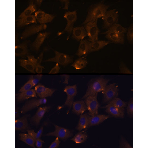 ARVCF Rabbit pAb