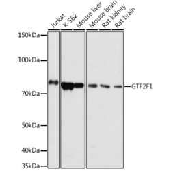GTF2F1 Rabbit pAb