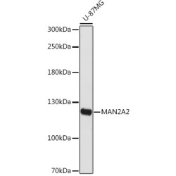 MAN2A2 Rabbit pAb
