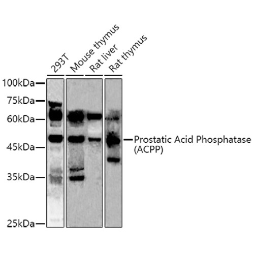 Prostatic Acid Phosphatase (ACPP) Rabbit pAb