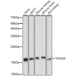 TOM20 Rabbit mAb