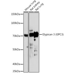 Glypican 3 (GPC3) Rabbit pAb