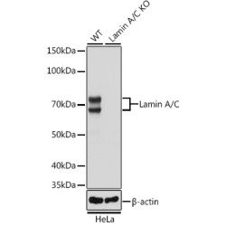 [KO Validated] Lamin A/C Rabbit mAb