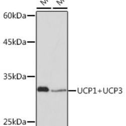 UCP1+UCP3 Rabbit mAb
