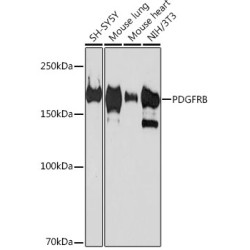 PDGFRB Rabbit mAb