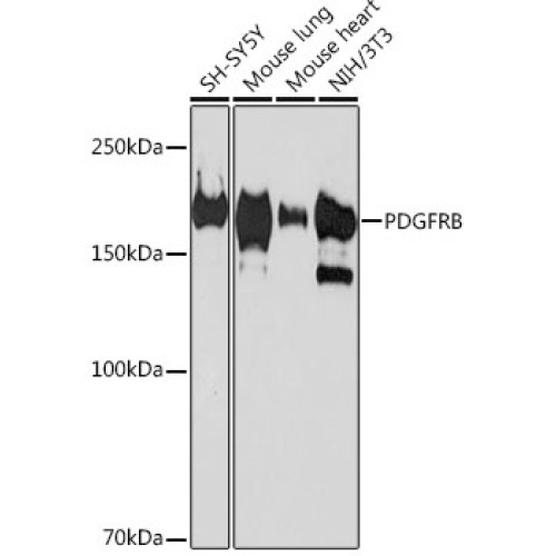 PDGFRB Rabbit mAb