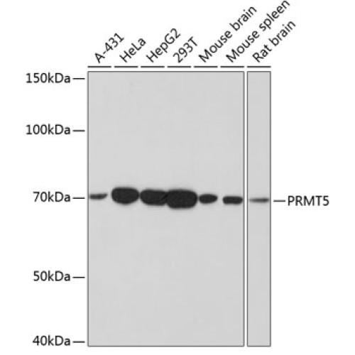 PRMT5 Rabbit mAb