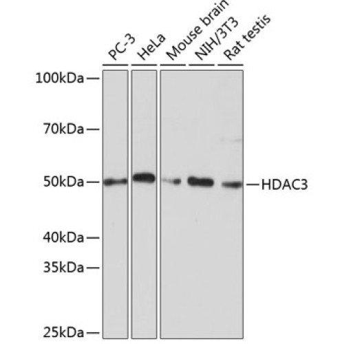 [KD Validated] HDAC3 Rabbit mAb