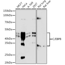 C/EBPB Rabbit mAb