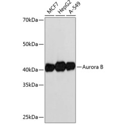 Aurora B Rabbit mAb
