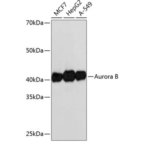 Aurora B Rabbit mAb
