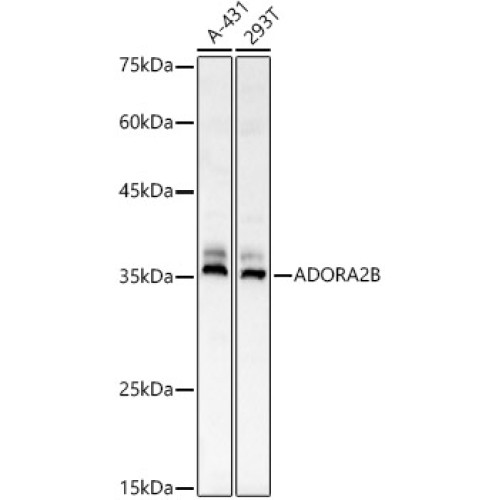 ADORA2B Rabbit pAb